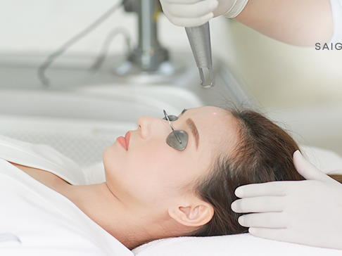 [Review] Điều trị nám laser có phải phương pháp thực sự hiệu quả?