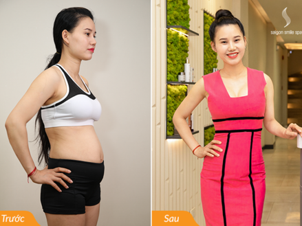 Bật mí 5 phương pháp giảm béo, giảm cân đang áp dụng tại Spa