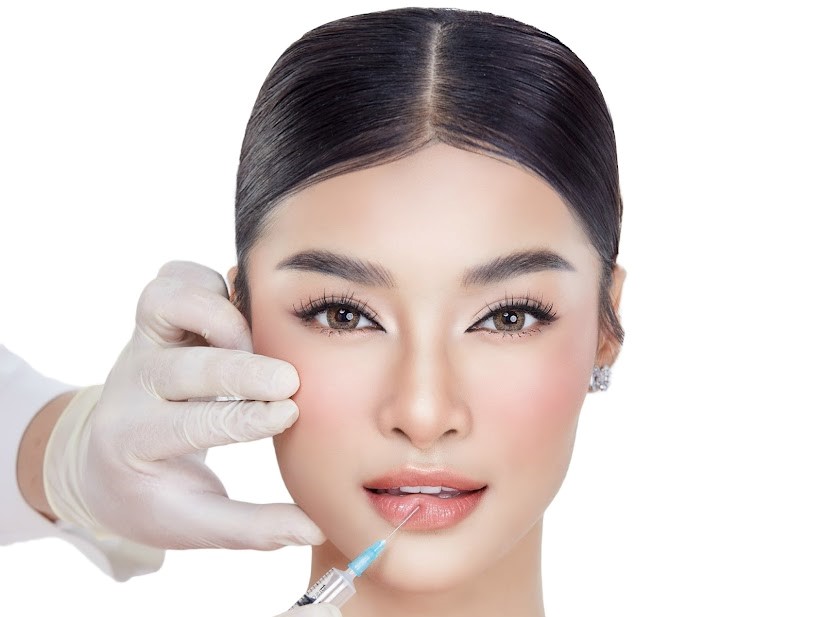Tiêm filler môi, giải pháp hoàn hảo cho đôi môi căng mọng