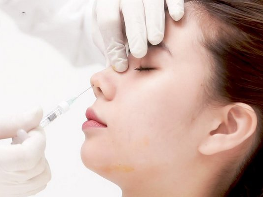 Trăm nghe không bằng một thấy – Khách hàng chia sẻ trải nghiệm tiêm filler mũi tại SaiGon Smile Spa