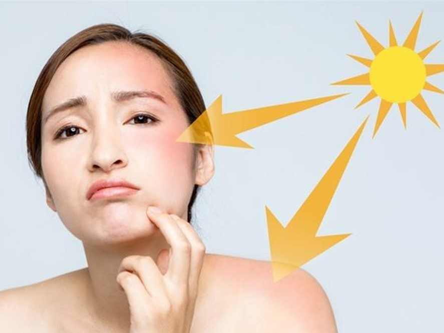 Trị nám thành công – Nhan sắc cô gái thăng hạng đến bất ngờ