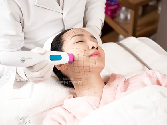 Phương pháp trẻ hóa bằng Thermage – cứu tinh cho làn da lão hóa