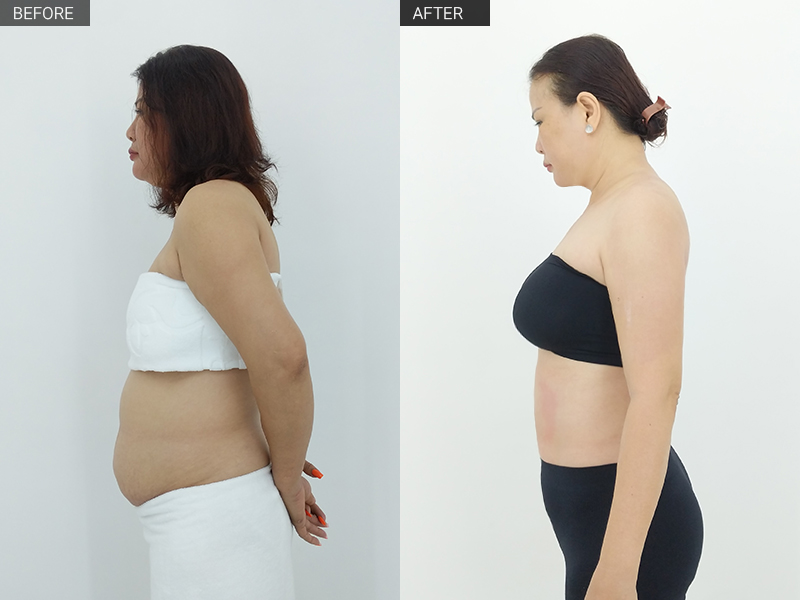 Bí quyết giảm mỡ bụng nhanh nhất ở tuổi ngoài 60