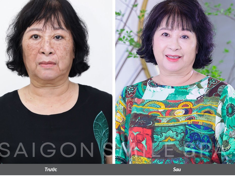 U60 gây ngạc nhiên vì làn da đẹp như thiếu nữ đôi mươi