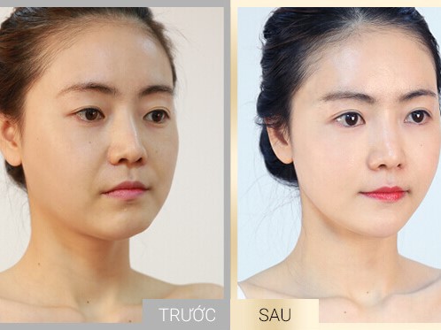 Nữ khách hàng U40 chia sẻ bí quyết trẻ hóa da ở đâu giúp khuôn mặt trẻ trung, thu hút