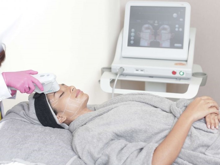 Lão hóa ngược với công nghệ nâng cơ mặt, căng da, xóa nhăn Ultherapy