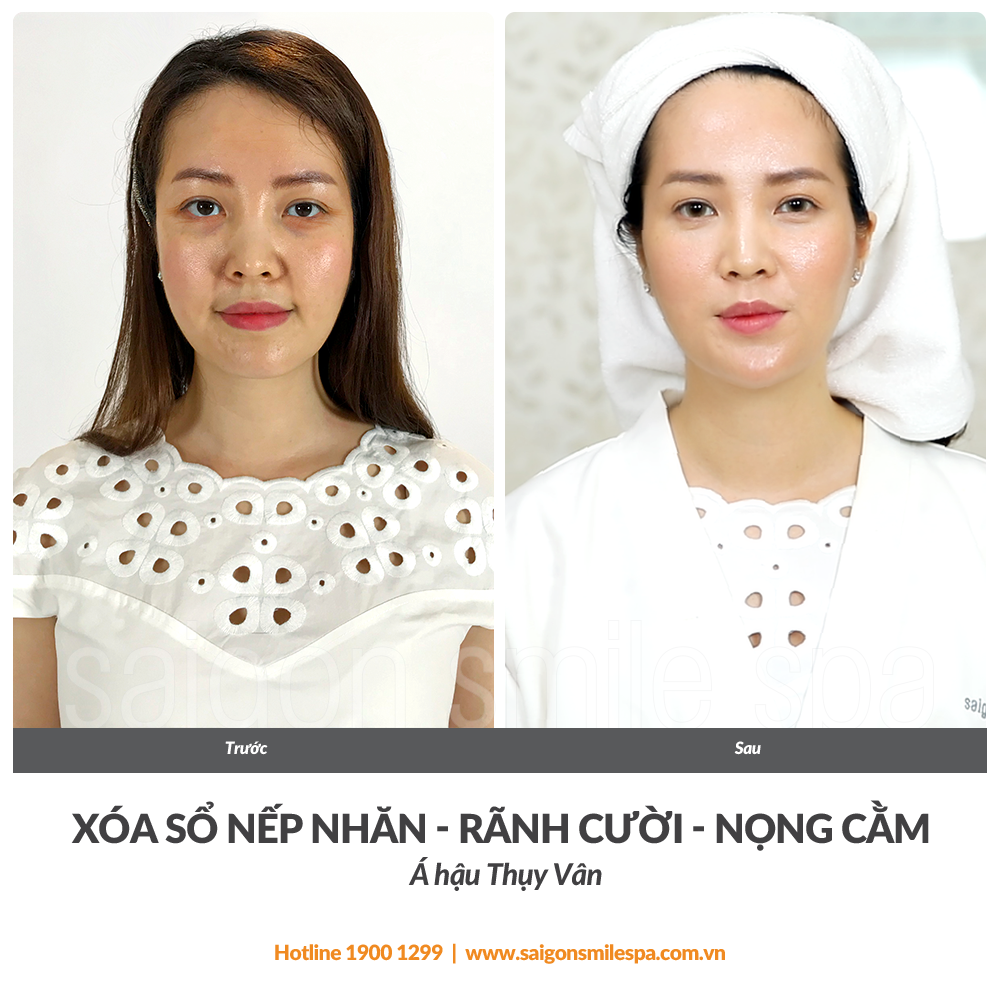 bằng giá