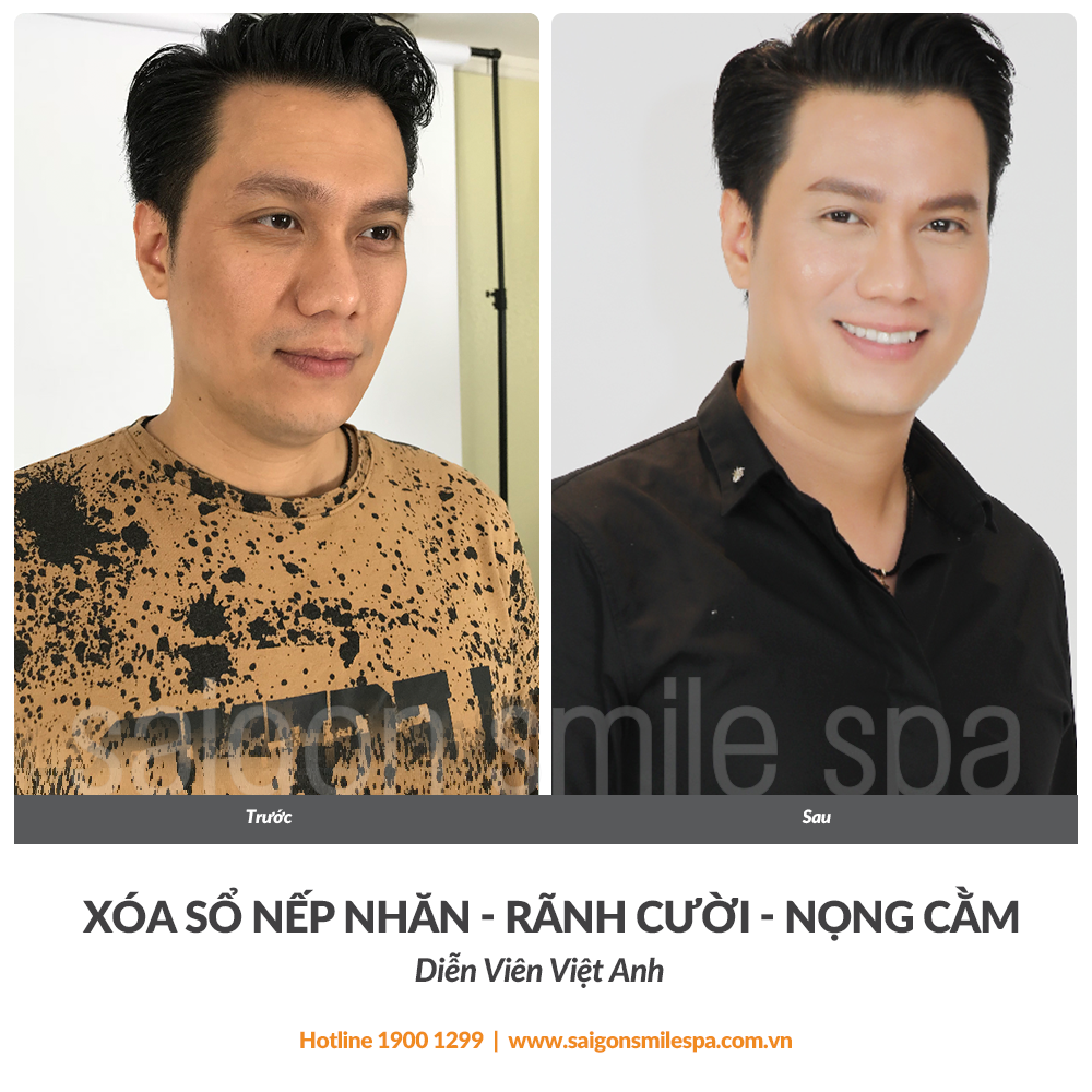 bằng giá