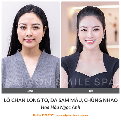 bằng giá