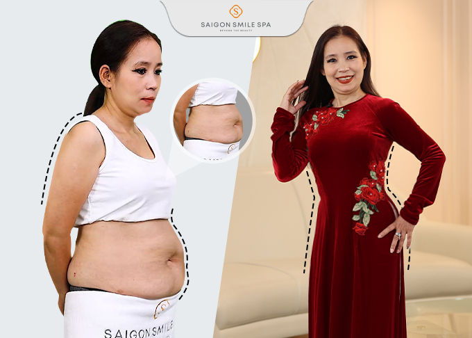 bụn lưu ý sao bí dui chuẩn y tự nhiên gì đúng bằng đột ngột mới đơn to review duoi chóng giản viện điều