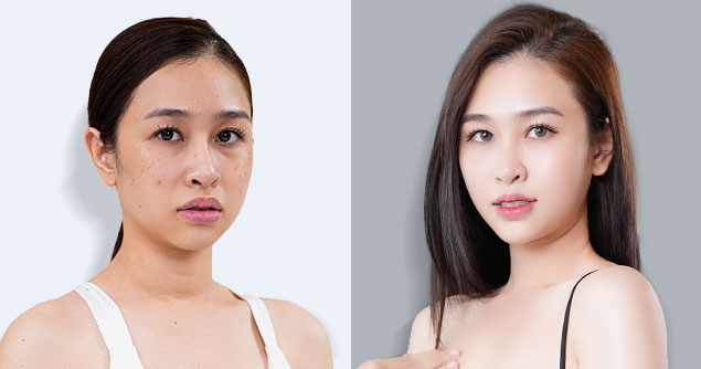 Chị Thu Mỹ