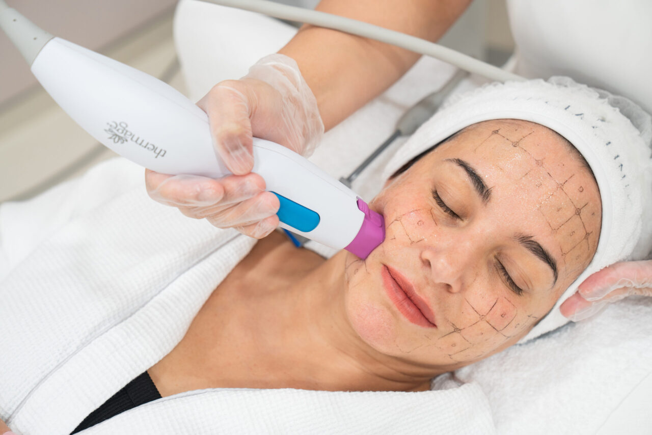 Giá Thermage FLX là bao nhiêu? Bảng giá Thermage FLX mới nhất và những lưu ý quan trọng trước khi làm.