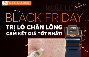 Black Friday 2025 – Xóa lỗ chân lông với Recell RF