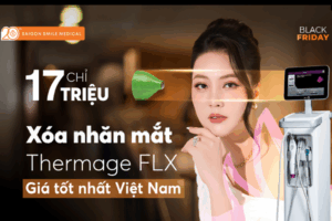 Xóa nhăn vùng mắt với Thermage FLX  Trẻ hóa chuẩn Mỹ chỉ 17 triệu
