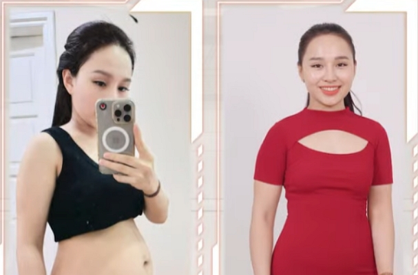 Giảm béo không xâm lấn bằng công nghệ AI Slimtech – Hiệu quả thực sự hay chỉ là lời quảng cáo?