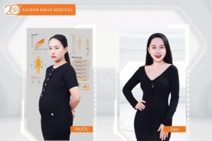 Phương pháp giảm mỡ an toàn cho mẹ 2 con: Vòng eo thon gọn rõ rệt sau 10 giờ trị liệu