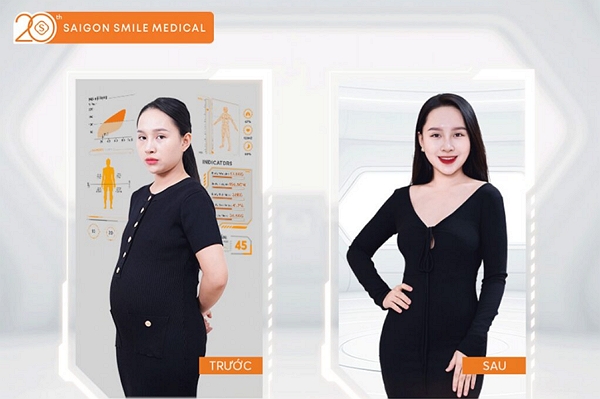 Phương pháp giảm mỡ an toàn cho mẹ 2 con: Vòng eo thon gọn rõ rệt sau 10 giờ trị liệu