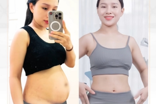 10 buổi AI Slimtech – Giảm 4kg & 29cm vòng bụng sau Tết