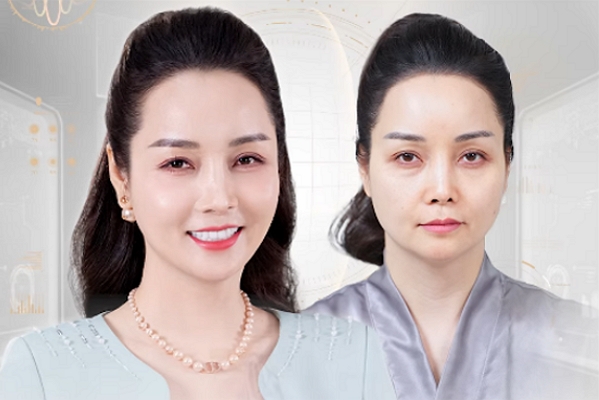 Trẻ ngay 10 tuổi sau 60 phút: Mai Thu Huyền “xóa sổ” nọng cằm & rãnh cười