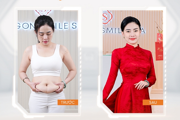MC Hoài Thu giảm 11kg & 34cm vòng bụng – Tự tin diện áo dài du xuân