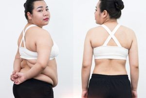 Khách hàng Diệu Linh giảm 23kg và 30cm bụng – an toàn – không xâm lấn