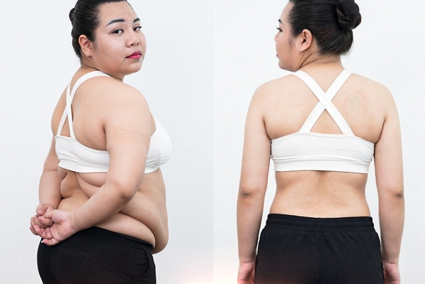 Khách hàng Diệu Linh giảm 23kg và 30cm bụng – an toàn – không xâm lấn
