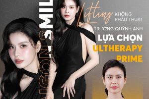 Trương Quỳnh Anh “chốt đơn” Ultherapy Prime Tại Saigon Smile