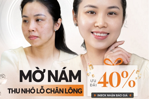 U40 – Làn da bắt đầu “xuống phong độ”?