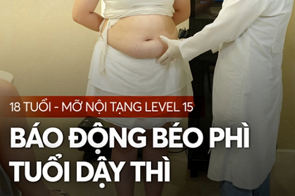 Báo động béo phì tuổi dậy thì: 18 tuổi – 73kg – Eo 105cm – Mỡ nội tạng Level 15
