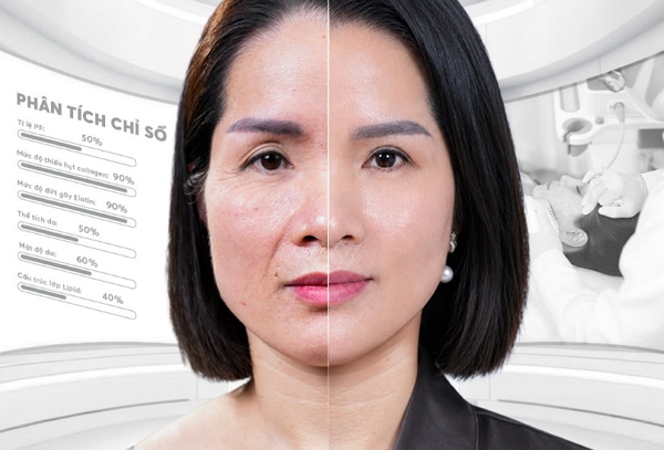 U40 dám để mặt mộc mới là “đẳng cấp” – Bí quyết giữ gương mặt săn chắc, tự nhiên