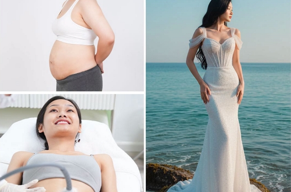 2 tháng giảm 8kg & 18cm vòng bụng – Cô dâu Trinh tự tin diện váy cưới mơ ước