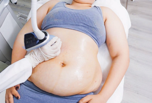 Tăng hơn 20kg sau khi cấy que tránh thai – Hành trình lấy lại vóc dáng của chị Phương Lê